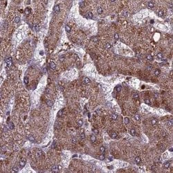 Invitrogen RCCD1 Polyclonal Antibody 100 &mu;L; Unconjugated:Antibodies,
