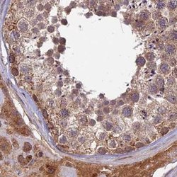 Invitrogen RCCD1 Polyclonal Antibody 100 &mu;L; Unconjugated:Antibodies,