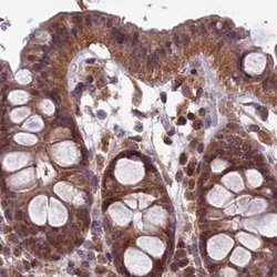 Invitrogen RCCD1 Polyclonal Antibody 100 &mu;L; Unconjugated:Antibodies,