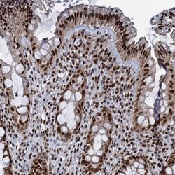 Invitrogen RPUSD4 Polyclonal Antibody 100 &mu;L; Unconjugated:Antibodies,