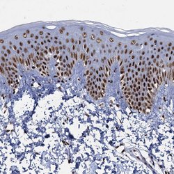 Invitrogen RPUSD4 Polyclonal Antibody 100 &mu;L; Unconjugated:Antibodies,
