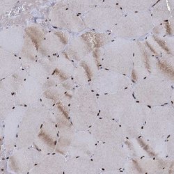 Invitrogen RPUSD4 Polyclonal Antibody 100 &mu;L; Unconjugated:Antibodies,