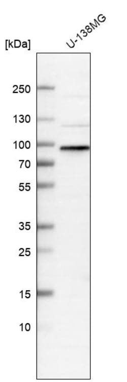 Invitrogen WHAMM Polyclonal Antibody 100 &mu;L; Unconjugated:Antibodies,