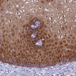 ADH7 Polyclonal Antibody:Antibodies, Polyclonal