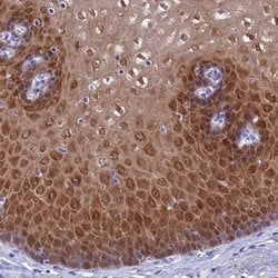 ADH7 Polyclonal Antibody:Antibodies, Polyclonal