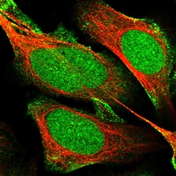 Invitrogen MPP8 Polyclonal Antibody 100 &mu;L | Buy Online | Invitrogen&trade; | Fisher Scientific