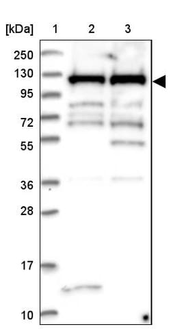 Invitrogen MPP8 Polyclonal Antibody 100 &mu;L | Buy Online | Invitrogen&trade; | Fisher Scientific