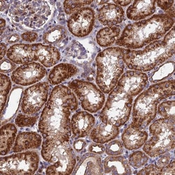 Invitrogen KIAA1468 Polyclonal Antibody 100 &mu;L; Unconjugated:Antibodies,