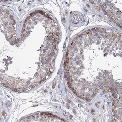 Invitrogen SMAGP Polyclonal Antibody 100 &mu;L | Buy Online | Invitrogen&trade; | Fisher Scientific