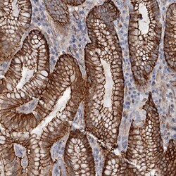 Invitrogen C12orf76 Polyclonal Antibody 100 &mu;L; Unconjugated:Antibodies,
