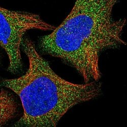 Invitrogen RAB3IL1 Polyclonal Antibody 100 &mu;L; Unconjugated:Antibodies,