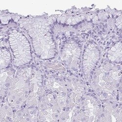 Invitrogen KRT78 Polyclonal Antibody 100 &mu;L; Unconjugated:Antibodies,