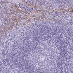 Invitrogen KRT78 Polyclonal Antibody 100 &mu;L; Unconjugated:Antibodies,