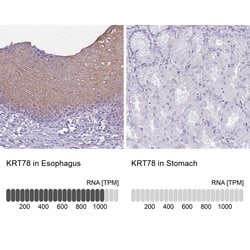 Invitrogen KRT78 Polyclonal Antibody 100 &mu;L; Unconjugated:Antibodies,