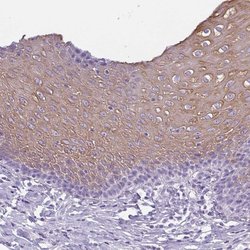 Invitrogen KRT78 Polyclonal Antibody 100 &mu;L; Unconjugated:Antibodies,