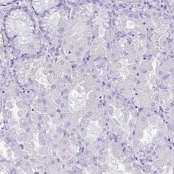 Invitrogen KRT78 Polyclonal Antibody 100 &mu;L; Unconjugated:Antibodies,