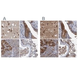 Invitrogen NBEA Polyclonal Antibody 100 &mu;L; Unconjugated:Antibodies,
