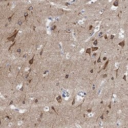 Invitrogen NBEA Polyclonal Antibody 100 &mu;L; Unconjugated:Antibodies,