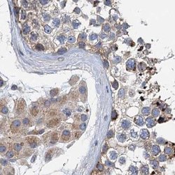 Invitrogen NBEA Polyclonal Antibody 100 &mu;L; Unconjugated:Antibodies,