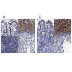 Invitrogen SCEL Polyclonal Antibody 100 &mu;L; Unconjugated:Antibodies,