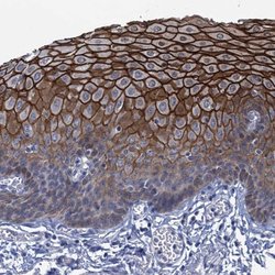 Invitrogen SCEL Polyclonal Antibody 100 &mu;L; Unconjugated:Antibodies,