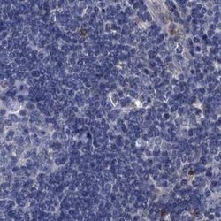 Invitrogen SCEL Polyclonal Antibody 100 &mu;L; Unconjugated:Antibodies,