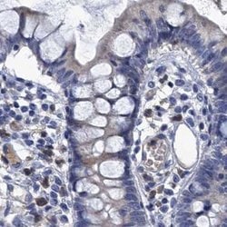 Invitrogen SCEL Polyclonal Antibody 100 &mu;L; Unconjugated:Antibodies,
