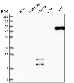 Invitrogen SCEL Polyclonal Antibody 100 &mu;L; Unconjugated:Antibodies,