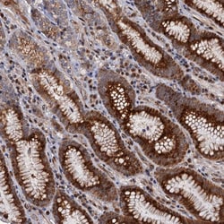 Invitrogen LRRC63 Polyclonal Antibody 100 &mu;L; Unconjugated:Antibodies,