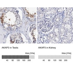 AKAP3 Polyclonal Antibody, Invitrogen 100 &mu;L; Unconjugated:Antibodies,