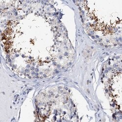 AKAP3 Polyclonal Antibody, Invitrogen 100 &mu;L; Unconjugated:Antibodies,