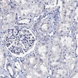 AKAP3 Polyclonal Antibody, Invitrogen 100 &mu;L; Unconjugated:Antibodies,
