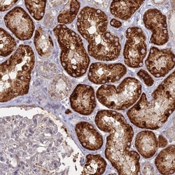 Invitrogen TBC1D30 Polyclonal Antibody 100 &mu;L; Unconjugated:Antibodies,