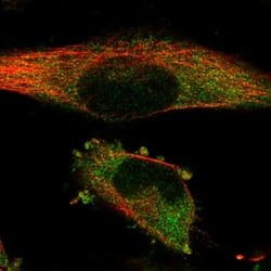 Invitrogen SSSCA1 Polyclonal Antibody 100 &mu;L; Unconjugated:Antibodies,