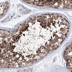 Invitrogen SSSCA1 Polyclonal Antibody 100 &mu;L; Unconjugated:Antibodies,