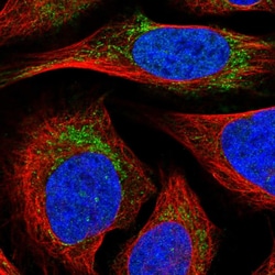 Invitrogen MTIF3 Polyclonal Antibody 100 &mu;L; Unconjugated:Antibodies,