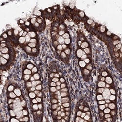 Invitrogen MTIF3 Polyclonal Antibody 100 &mu;L; Unconjugated:Antibodies,
