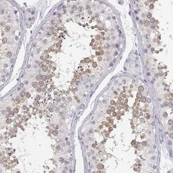 GLIPR1L2 Polyclonal Antibody 100 &mu;L | Buy Online | Thermo Scientific | Fisher Scientific