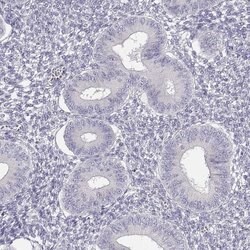 GLIPR1L2 Polyclonal Antibody 100 &mu;L | Buy Online | Thermo Scientific | Fisher Scientific