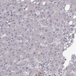 Invitrogen B3GNT6 Polyclonal Antibody 100 &mu;L; Unconjugated:Antibodies,