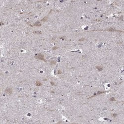 Invitrogen B3GNT6 Polyclonal Antibody 100 &mu;L; Unconjugated:Antibodies,