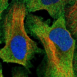 TTC23 Polyclonal Antibody:Antibodies, Polyclonal
