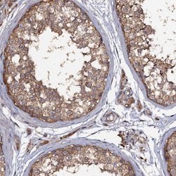 TTC23 Polyclonal Antibody:Antibodies, Polyclonal