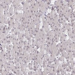 Invitrogen GOLGA3 Polyclonal Antibody 100 &mu;L; Unconjugated:Anticuerpos