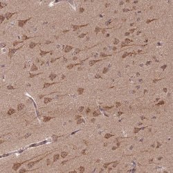 Invitrogen GOLGA3 Polyclonal Antibody 100 &mu;L; Unconjugated:Anticuerpos