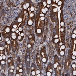 Invitrogen WWC3 Polyclonal Antibody 100 &mu;L; Unconjugated:Antibodies,