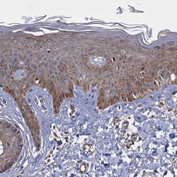 Invitrogen WWC3 Polyclonal Antibody 100 &mu;L; Unconjugated:Antibodies,