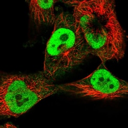 Invitrogen RTRAF Polyclonal Antibody 100 &mu;L; Unconjugated:Antibodies,