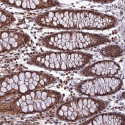 Invitrogen RTRAF Polyclonal Antibody 100 &mu;L; Unconjugated:Antibodies,