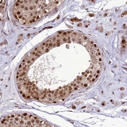 Invitrogen RTRAF Polyclonal Antibody 100 &mu;L; Unconjugated:Antibodies,